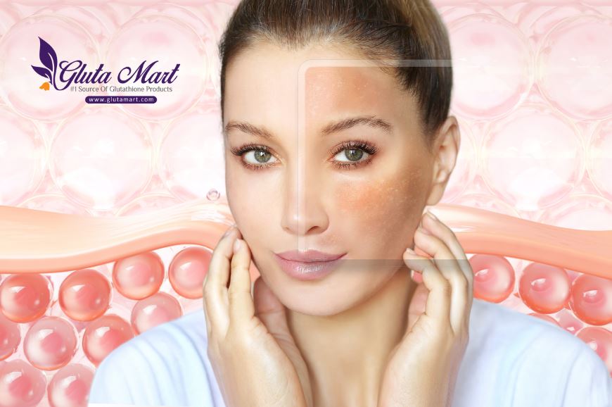 Glutathione Skin Whitening Soap: Your Ultimate Solution for Radiant Skin